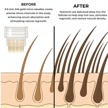 CROWNRise™ Micro-Infusion Hair Rejuvenation System